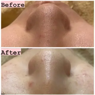 ハーブピーリング専門 muro.のエステ・リラクイメージ