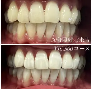 メンズ キッズ ホワイトニングルーム　川崎店所属・ホワイトニング ルーム　川崎店のその他イメージ