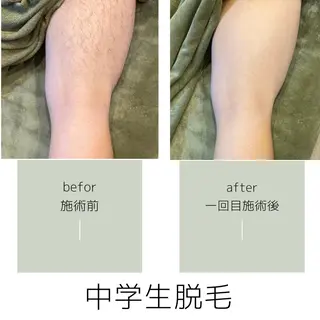 salon mijoaのエステ・リラクイメージ