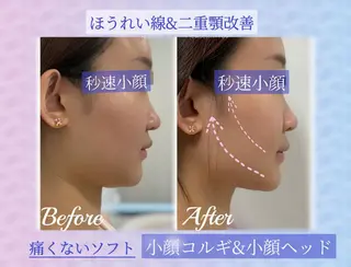 毛穴洗浄& 睫毛パーマ上野御徒町のマツエク・マツパデザイン