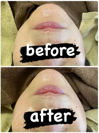 【痩身・脱毛サロン】 REBISKIN🌱のエステ・リラクイメージ