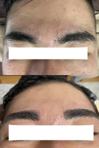 メンズ キッズ アイブロウ Epina 千葉店 【エピナ】のエステ・リラクイメージ