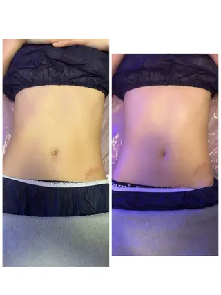 esthesalon Ran所属・小顔美肌痩身サロン Ranのその他イメージ