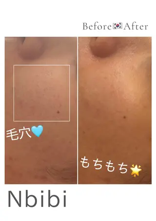 韓国🇰🇷価格 サロン_Nbibiのエステ・リラクイメージ