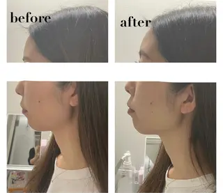 ENCHANT 脱毛.小顔.毛穴のエステ・リラクイメージ