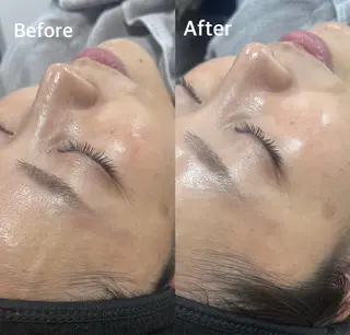 小顔専門看護師クリニカルサロンCOCO所属・小顔と美肌サロン クリニカルサロンココのエステ・リラクイメージ