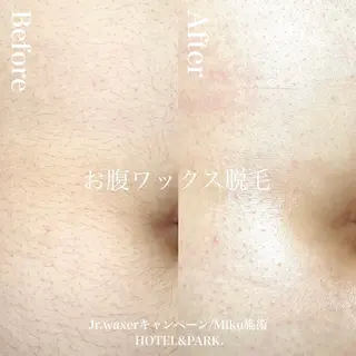 HOTEL&PARK Mikuワックス脱毛のエステ・リラクイメージ