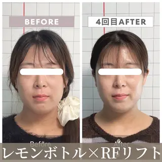 小顔矯正専門店 【RED】池田のエステ・リラクイメージ