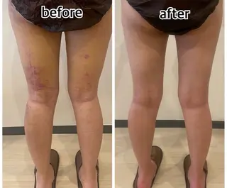 💎インディバ GEM💎indiba   healing room GEM所属・💎 GEM💎のエステ・リラクイメージ