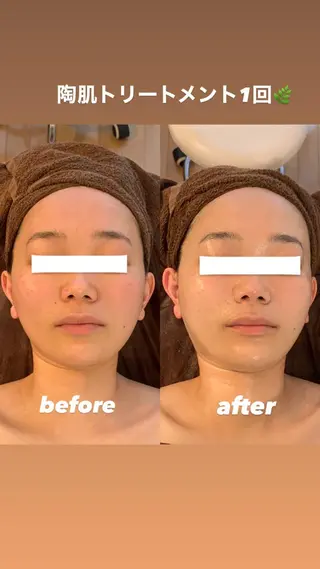 プライベートサロンsoleil所属・プライベートサロン soleilのエステ・リラクイメージ