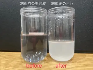 TLIENGLE高宮 エステ・ネイルのエステ・リラクイメージ