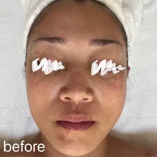 肌質改善|天王寺 For...はるかのエステ・リラクイメージ