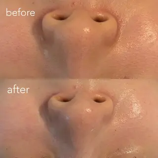 エステティックサロン Liente(リアンテ)所属・Hashimoto .のエステ・リラクイメージ