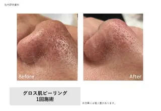 メンズ 韓国肌管理BEAUTY-SALON Teena【ティーナ】ララピール/毛穴/脱毛所属・心斎橋眉毛サロン hiyoriの眉毛・アイブロウイメージ