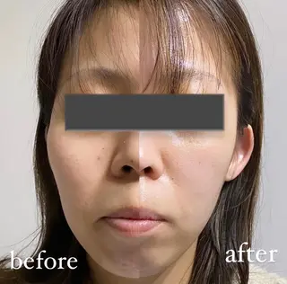 Designer EGGのマツエク・マツパデザイン