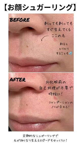 シュガーリング 【MARLS】の眉毛・アイブロウイメージ