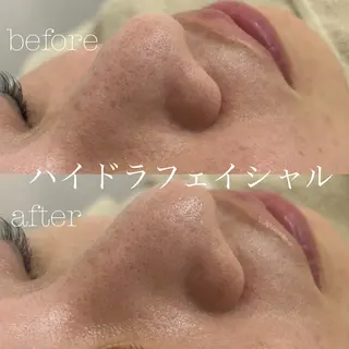 フェイシャルサロン CHIARA 荒田のエステ・リラクイメージ