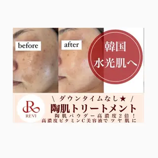 Horishia 福岡博多店のエステ・リラクイメージ