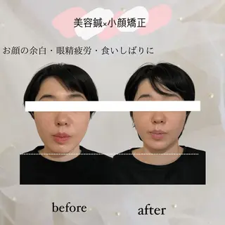 harisalon aleumのエステ・リラクイメージ