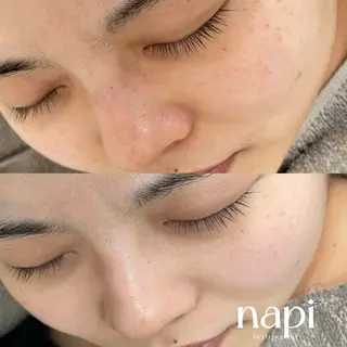 ハーブピーリング 専門店napiのエステ・リラクイメージ