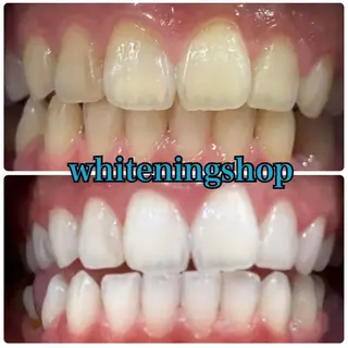 ホワイトニング ショップ吉祥寺店のエステ・リラクイメージ