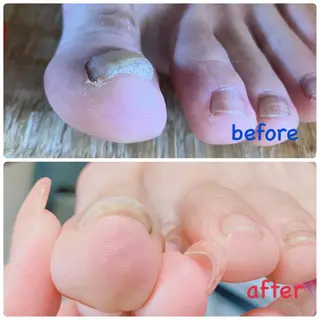 ネイル 柴崎 美幸のネイルデザイン