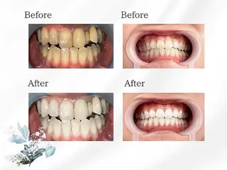 CY PLUS よもぎ蒸し&ホワイトのその他イメージ