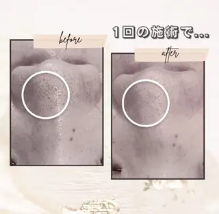 AY'S所属・倉敷/玉島/毛穴洗浄 古川碧のエステ・リラクイメージ