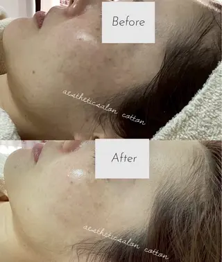 都度払い 肌質改善専門サロンのエステ・リラクイメージ