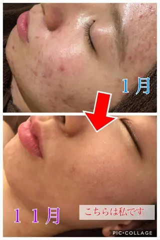 セミロング カラー パーマ ヘアアレンジ メンズ キッズ ネイル マツエク・マツパ 四つ星サロン🎖 腸＆ニキビケアに特化のエステ・リラクイメージ