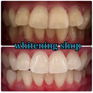 ホワイトニング ショップ吉祥寺店のエステ・リラクイメージ