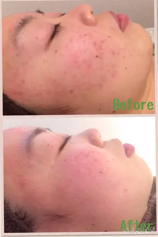 ロング カラー パーマ ヘアアレンジ メンズ キッズ ネイル マツエク・マツパ アニメ,Vオタク× 即効痩せエステサロンのエステ・リラクイメージ