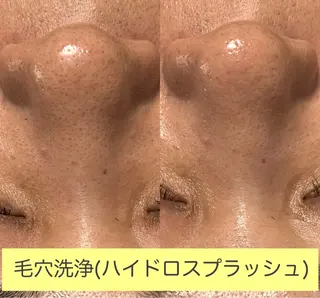 Lea Makana-レアマカナ所属・毛穴洗浄🍀脱毛🍀 光フェイシャル🍀のエステ・リラクイメージ