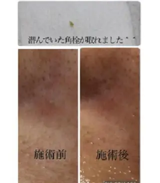 BUHTI本八幡 Okudairaのエステ・リラクイメージ