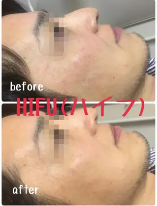 肌質改善サロンChouChou所属・肌質改善サロン chouchouのエステ・リラクイメージ