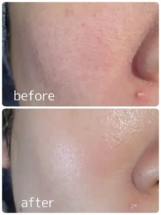 REGARD所属・Taniguchi Mのエステ・リラクイメージ