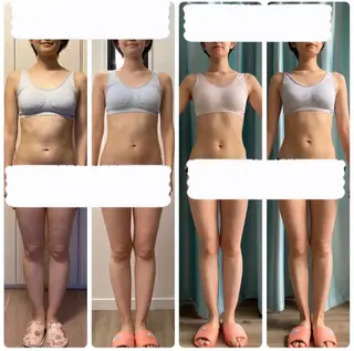 即小顔♥️美容鍼× ハーブピーリングのその他イメージ