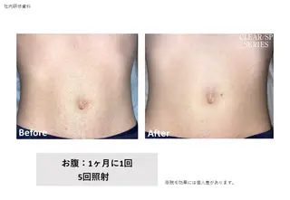 VIERU YURIのネイルデザイン