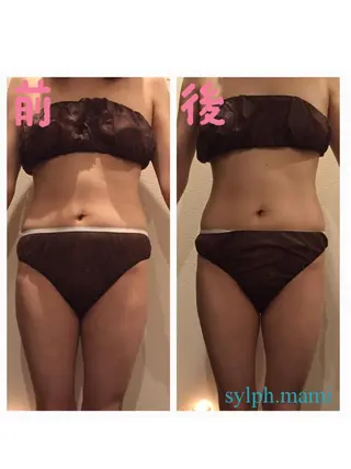 毒素出し専門サロンSylph(なかがわ整骨院併設サロン)所属・Mami Hataのエステ・リラクイメージ