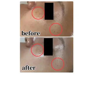 Beauty salonBellのエステ・リラクイメージ