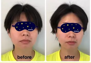 脱毛サロンWillow所属・脱毛サロン Willow/宮島のエステ・リラクイメージ