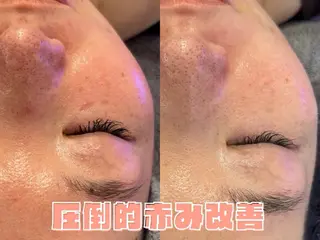 韓国肌管理ララピール クリスタルビューティのエステ・リラクイメージ