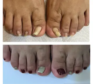 ネイル nico +所属・nico + 鷲野のネイルデザイン