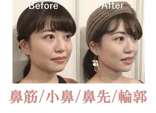 美鼻&小顔専門店 ラプリ 毛井のエステ・リラクイメージ