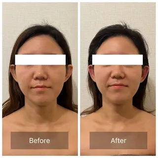 Parafuse.ayumi所属・平井 歩美のエステ・リラクイメージ