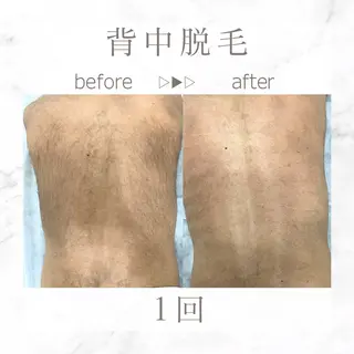 メンズ エステサロンNarcis〜ナルシス〜所属・脱毛＆痩身エステ Narcisのエステ・リラクイメージ