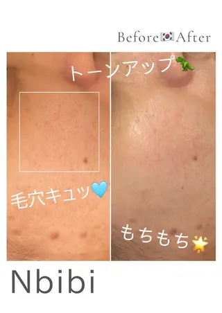 韓国🇰🇷価格 サロン_Nbibiのエステ・リラクイメージ