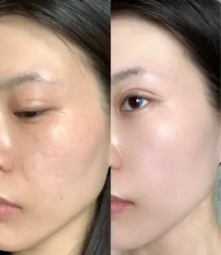 愛維美水光美肌専門店所属・愛維美水光美肌専門店 メンズレディースokのエステ・リラクイメージ