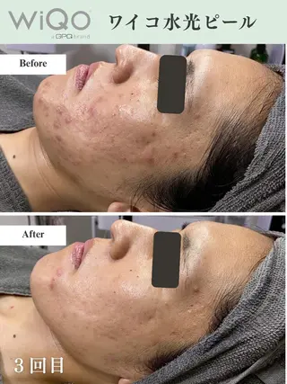 脱毛・眉毛・フェイス サロンN久留米店のその他イメージ