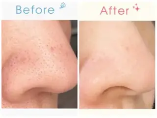 Jessica⭐️ 平島のマツエク・マツパデザイン